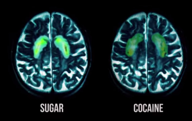 9 Things Really Happen Inside The Body When You Eat Too Much Sugar