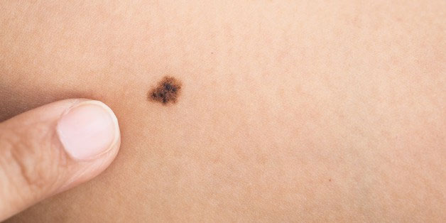 Picture 1 of A cancer vaccine gives 100% efficiency in mouse testing