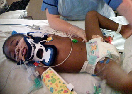 Picture 1 of A girl who doesn't breathe nearly 20 minutes still lives