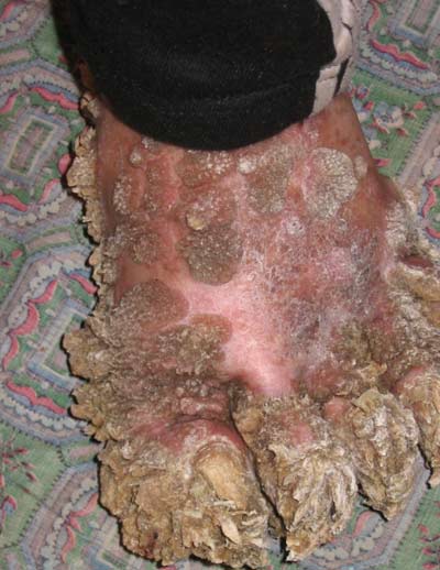 Picture 1 of A horrifying 'horny' case in Europe