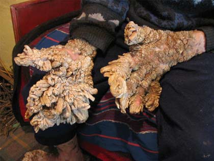 Picture 3 of A horrifying 'horny' case in Europe