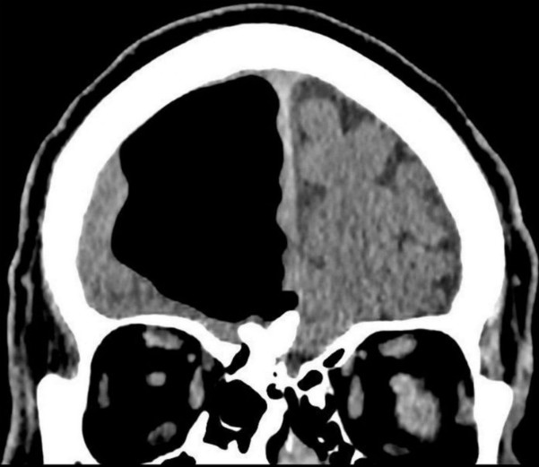 Picture 1 of A lost '1/4' brain makes the doctor confused