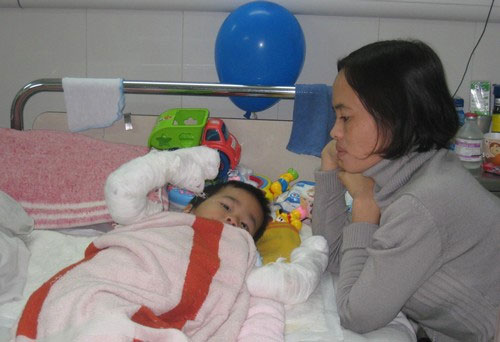 Picture 1 of A lot of children suffer burns because of careless adults