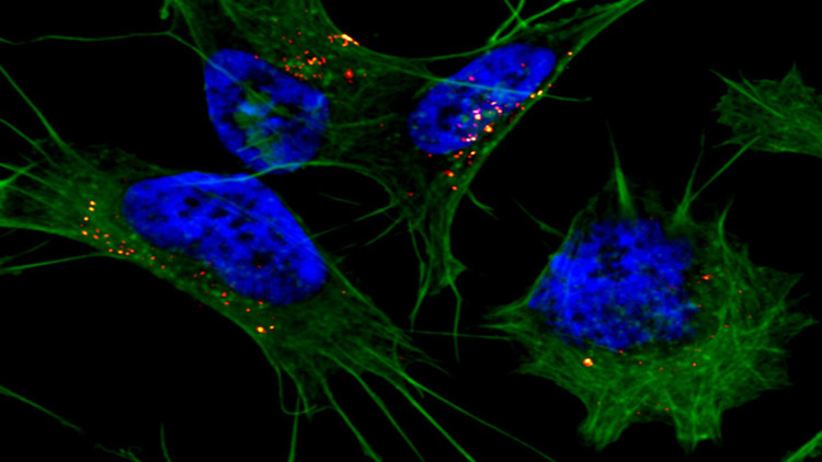 Picture 1 of A new step in controlling the disease could result in 13.8 million deaths