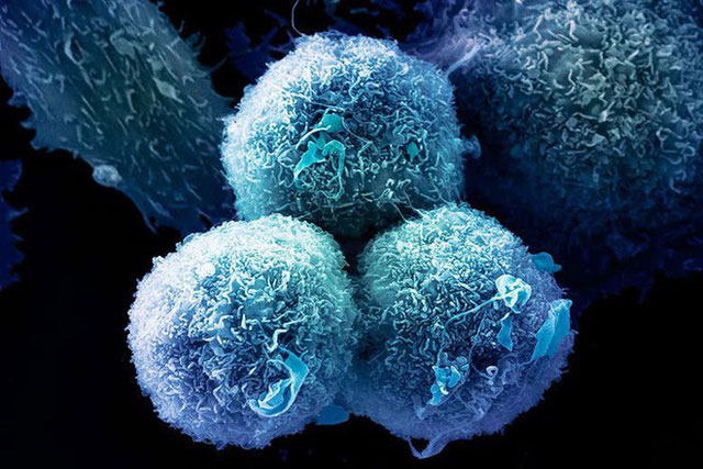 Picture 2 of A new targeted drug could reduce 67% of all cancer cancers in humans