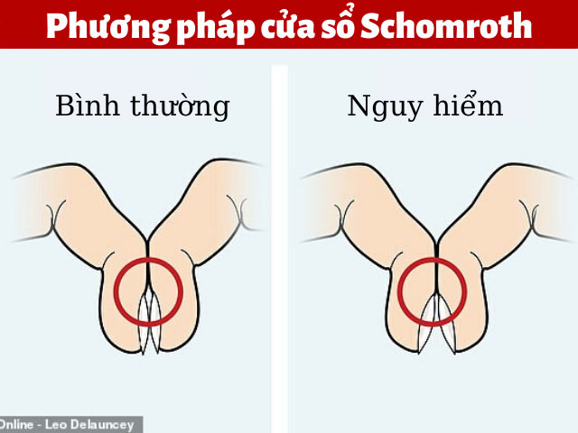 A simple operation with your finger can tell if you have lung cancer or not images 1