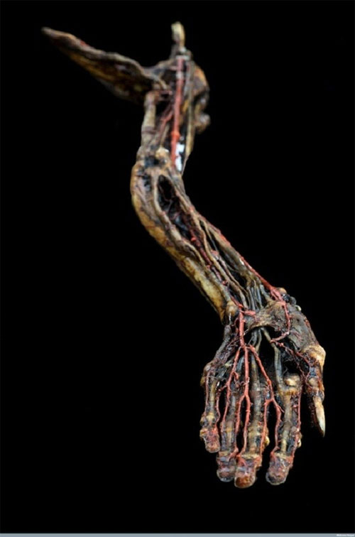 Picture 4 of A variety of gruesome to sexy magnetic anatomical models of the past