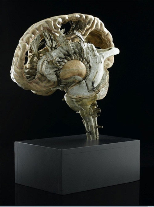 Picture 6 of A variety of gruesome to sexy magnetic anatomical models of the past