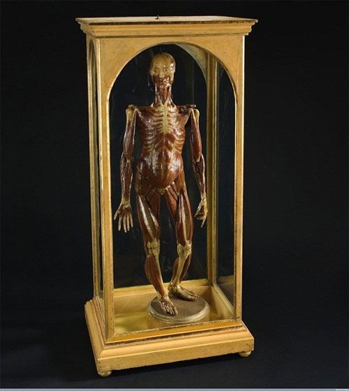 Picture 7 of A variety of gruesome to sexy magnetic anatomical models of the past
