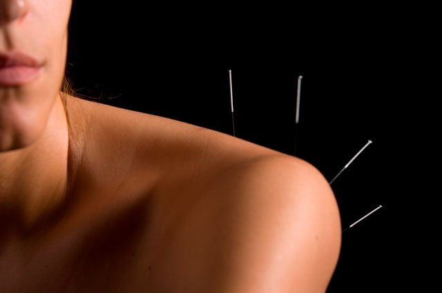 Picture 1 of Acupuncture helps women with breast cancer reduce fatigue