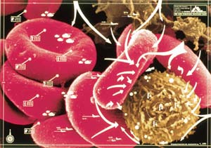 Picture 2 of After 25, why have not found drugs to treat AIDS?