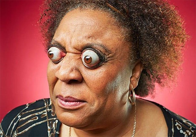 Picture 1 of After the accident, the woman had a monstrous disease: Arbitrary control of the eyeball