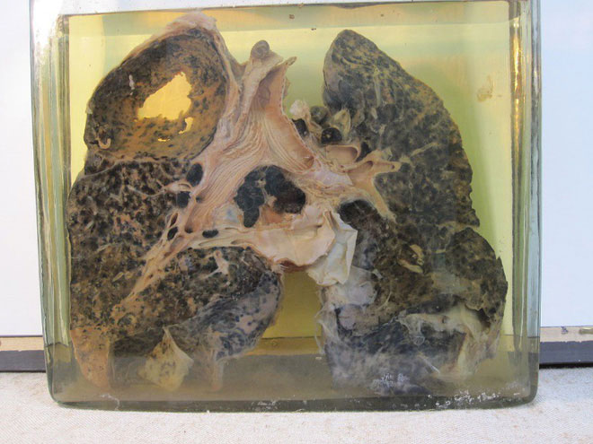 Picture 2 of Air quality is alarming, scientists warn of diseases caused by dust pollution
