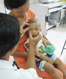 Picture 2 of Alarm eye cancer