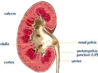 Picture 1 of Alcohol destroys all organs
