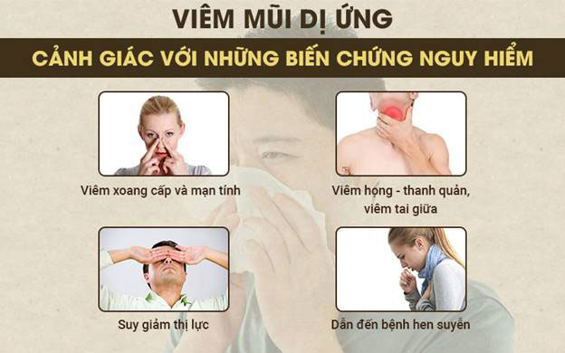 Picture 3 of Allergic rhinitis: Causes, symptoms and treatment