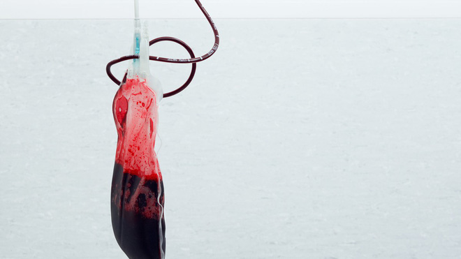 Picture 2 of Amazed with the blood group is likened to 'pure gold', and only 43 people in the world have it