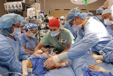 Picture 1 of America: Successfully separated conjoined twins