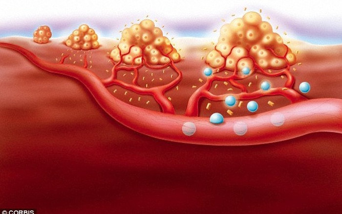 Picture 3 of American scientists have found a way to prevent cancer from spread