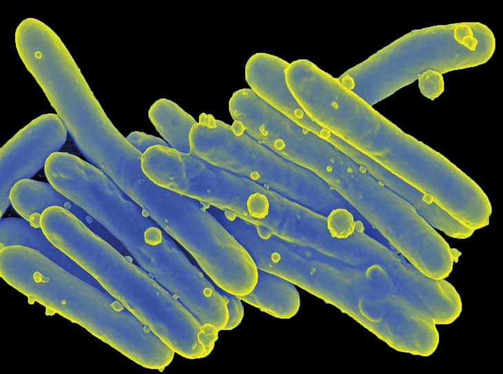 Picture 2 of Ancient bacteria causing leprosy are mutating