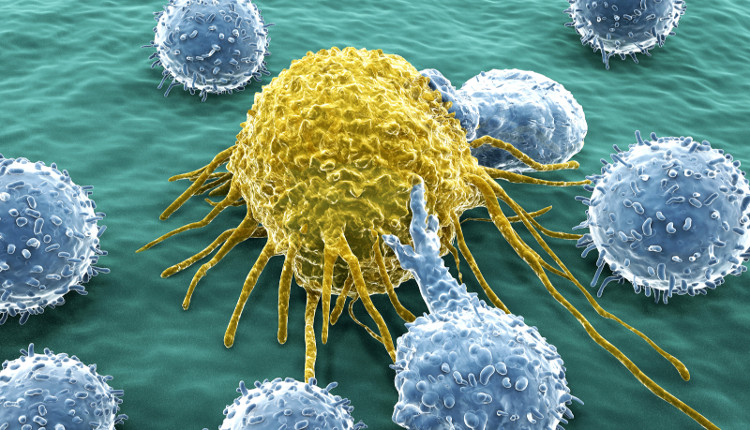 Picture 1 of Answer 11 common questions about cancer