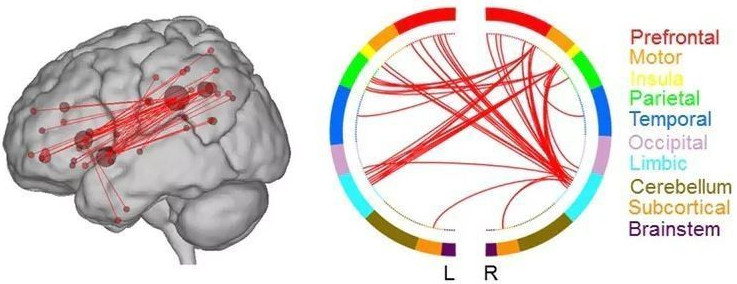 Picture 3 of Answer the mystery why some people have creative minds for genius