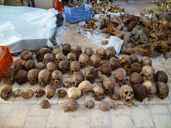 Picture 3 of Archeology of fetal remains reveals medieval abortion methods