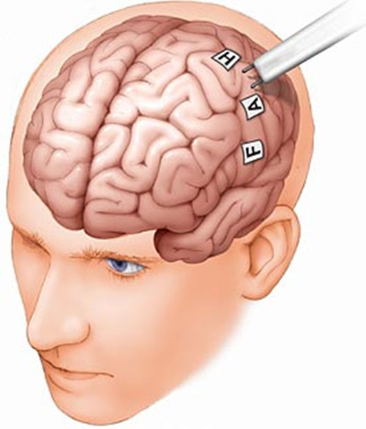Picture 3 of Are we only using 10% of the brain?