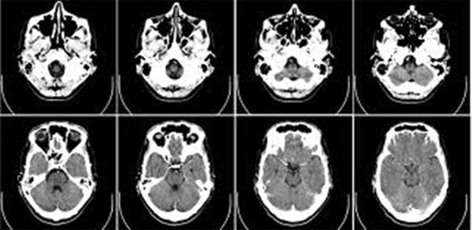Picture 6 of Are we only using 10% of the brain?