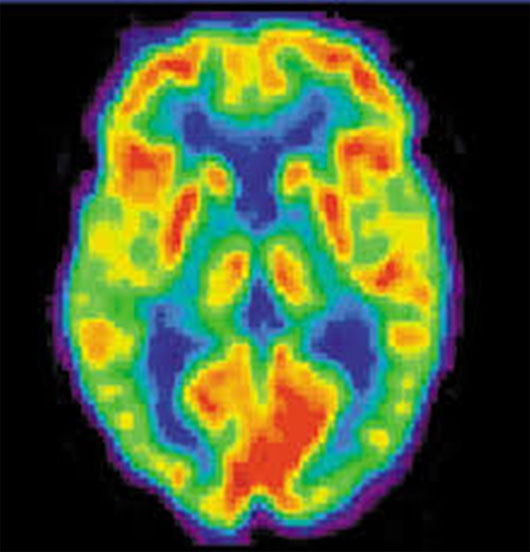 Picture 7 of Are we only using 10% of the brain?