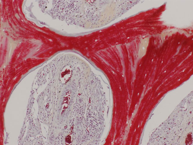 Picture 1 of Artificial bone from transplanted pig cells for humans