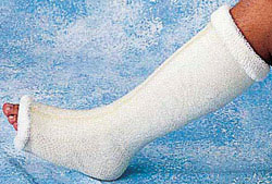 Picture 1 of Artificial bone made from wood