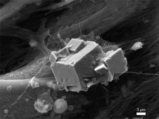 Picture 1 of Artificial bones from umbilical cord stem cells