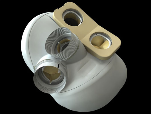 Picture 2 of Artificial heart self-regulating Carmat for the first time implanted