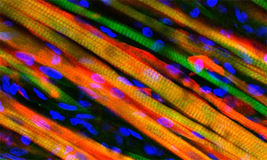 Picture 1 of Artificial muscle replaces itself