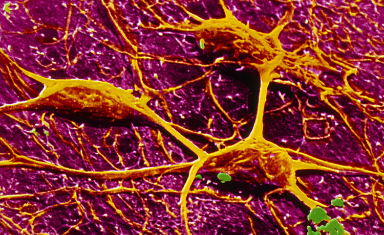 Picture 1 of Artificial neurons are faster than human brain