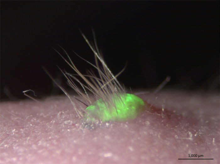 Picture 1 of Artificial skin has hair and sweat glands