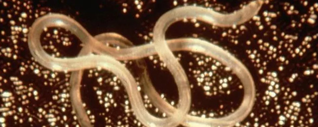 Picture 1 of Ascaris help solve infertility in women?