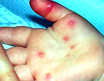 Picture 2 of Asia is concerned about the outbreak of foot and mouth disease