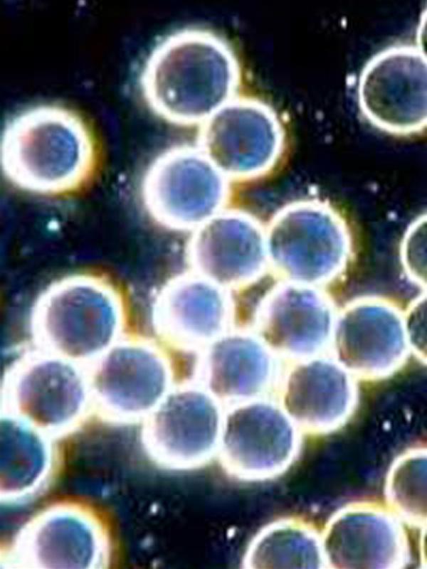 Picture 3 of Atomic nano batteries can operate for hundreds of years