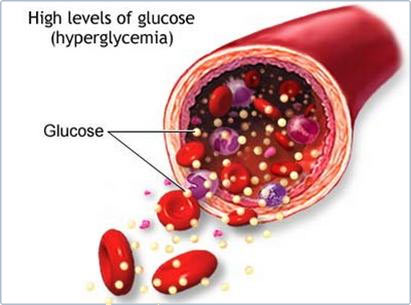Picture 1 of Australia: Insulin cell transplantation for patients with type I diabetes