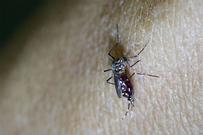 Picture 1 of Avoid kissing, abstinence to prevent Zika virus