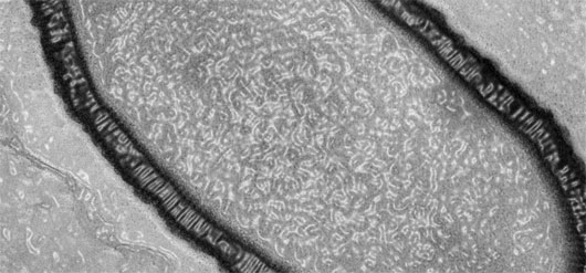 Picture 1 of Awakening the virus once existed 30,000 years ago