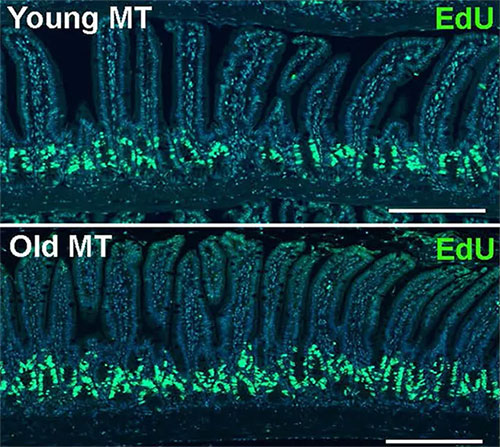Picture 1 of Bacteria in the gut can change the aging process