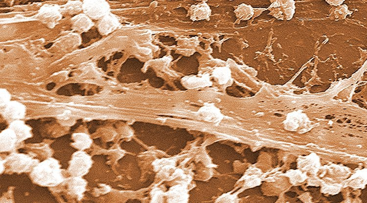 Picture 1 of Bacteria turned out to talk