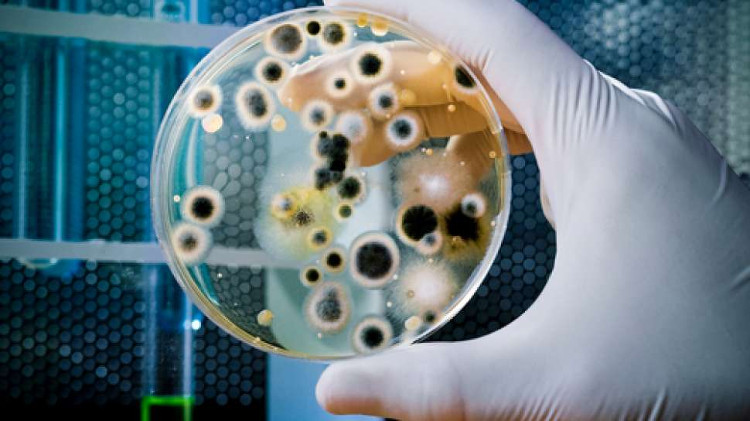 Picture 3 of Bacteria turned out to talk