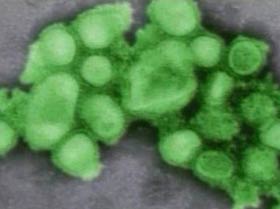 Picture 1 of Bacterial infections: The fatal culprit in many influenza A / H1N1 patients