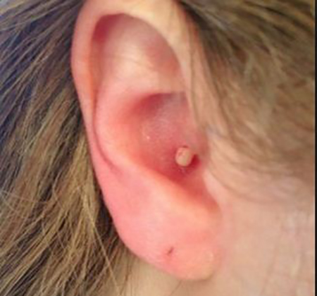 Picture 1 of Be careful when you see your ear showing this sign