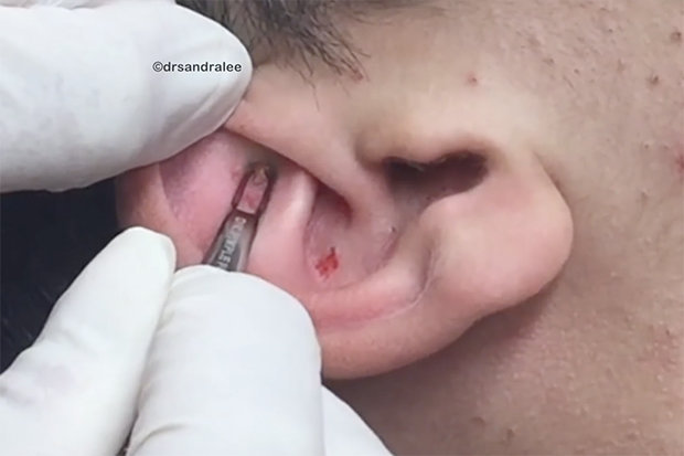 Picture 3 of Be careful when you see your ear showing this sign