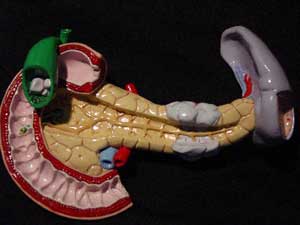 Picture 1 of Be wary of acute pancreatitis